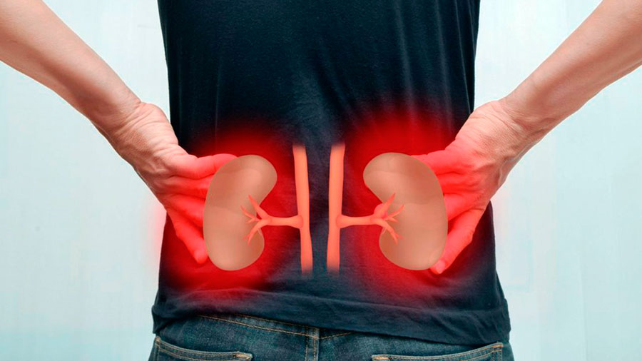 Hablemos de Enfermedad Renal Crónica